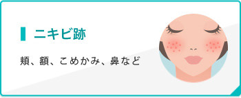 ニキビ跡