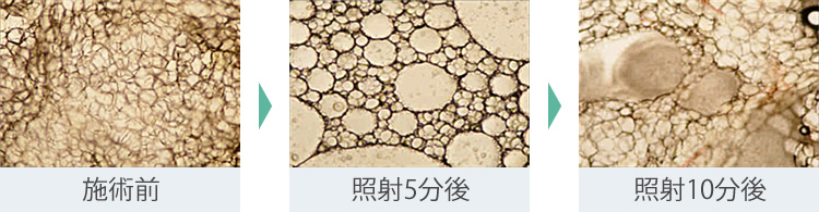 溶かす、排出する、引き締める!が同時に作用