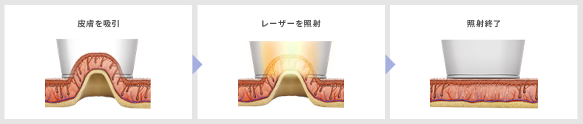 毛のメラニンに効率的に吸収させることが可能