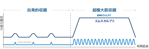 超極大筋収縮