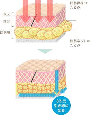 近赤外線で照射