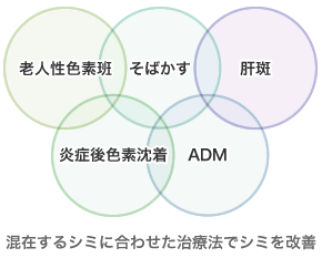 老人性色素班・そばかす・肝斑・炎症後色素沈着・ADM