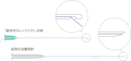 先端が丸い針で内出血を予防