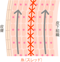 特殊なコグ（突起）で引き上げ力UP