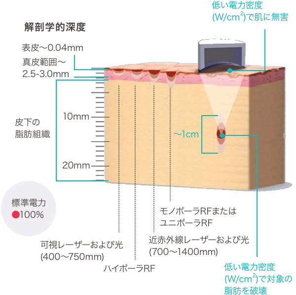 HIFU(ハイフ)を使って皮下脂肪にアプローチ