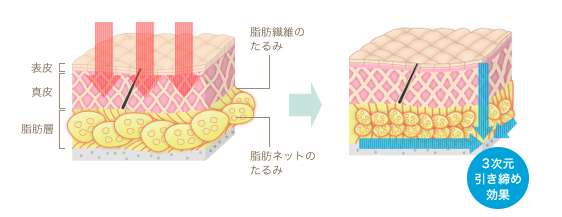 近赤外線で照射